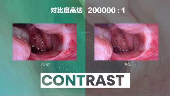 07 海信發(fā)布全球首臺55吋Mini-LED醫(yī)用內(nèi)窺顯示器365.png